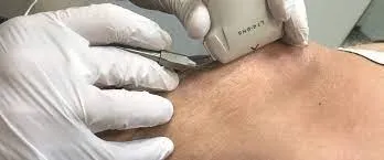 Echodiagnostiek